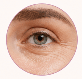 Anti-Ageing