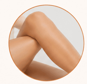 Laser Hair Removal