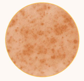 Pigmentation
